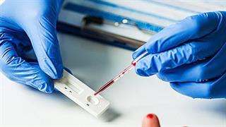 Σε κατεπείγουσα προμήθεια 3 εκατομμυρίων rapid test προχωρά ο ΕΟΔΥ