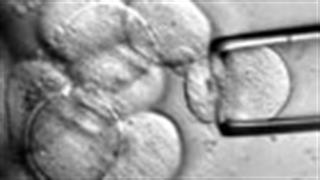 Δημόσιες και ιδιωτικές τράπεζες βλαστοκυττάρων