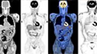 Νέες τεχνολογίες στην ακτινολογία