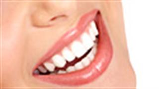 Lifting δοντιών