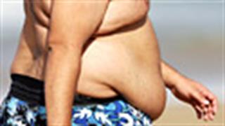 Χειρουργική αντιμετώπιση της παχυσαρκίας