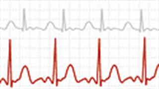  Συγγενείς καρδιοπάθειες