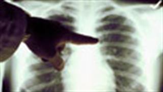 Πανελλήνιο Πνευμονολογικό Συνέδριο