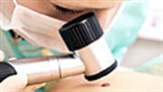 Πώς αφαιρούνται οι ύποπτες ελιές