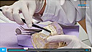 Σωστός τρόπος βουρτσίσματος δοντιών