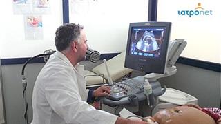 Υγειονομική περίθαλψη για εγκύους και νεογνά ευάλωτων πληθυσμιακών ομάδων